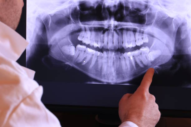 Best Emergency Tooth Extraction in Soh Weber, UT